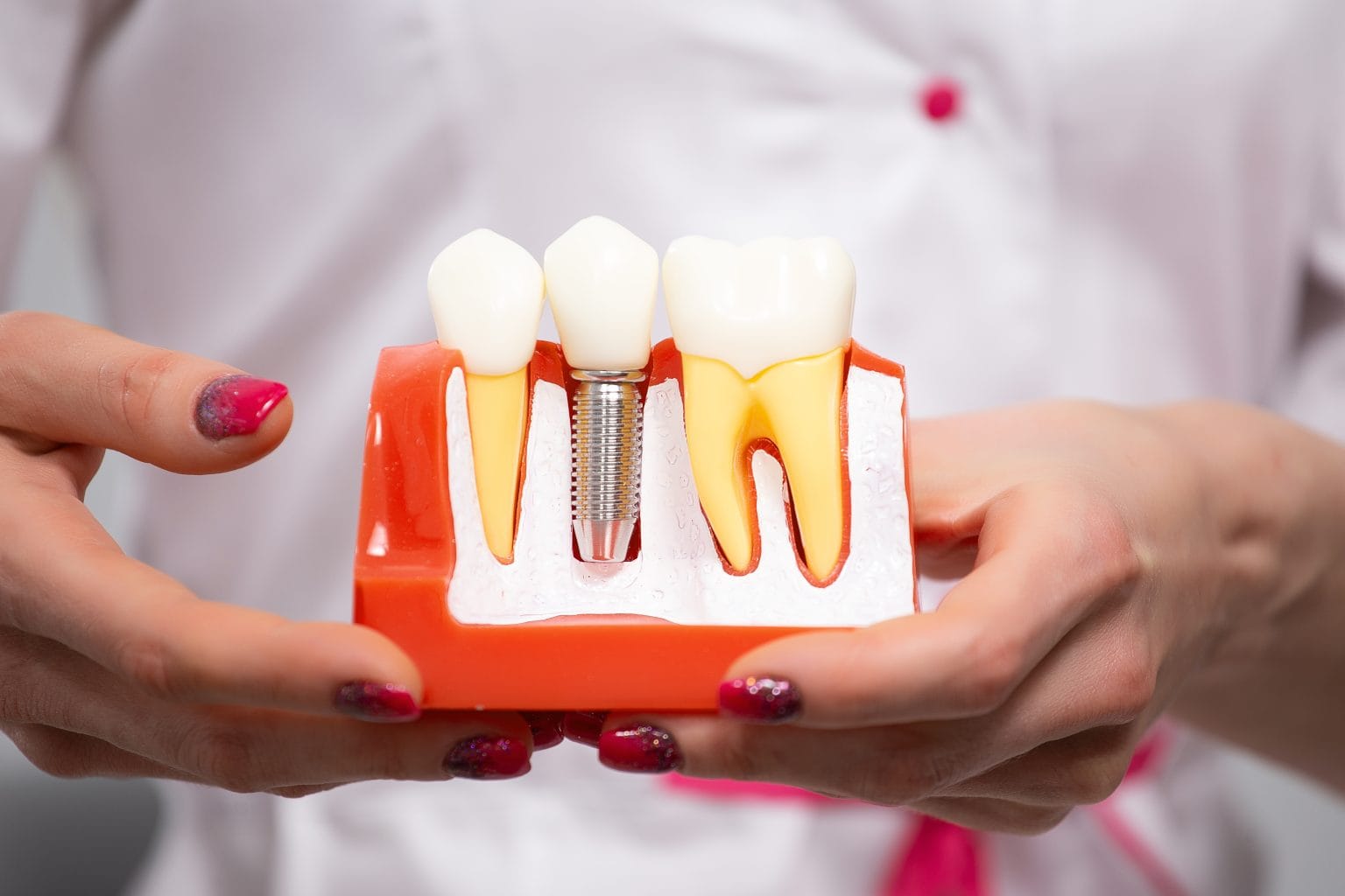 The Complete Guide to Determining Eligibility for Dental Implants